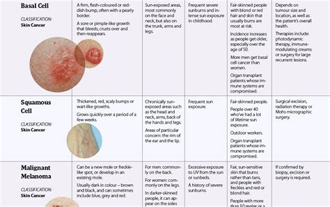 What Does Early Stage Basal Cell Carcinoma Look Like Common Types Of