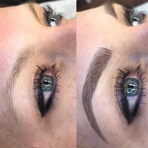 Fingers Crossed For Some Beautiful New Brows Indymicroblading
