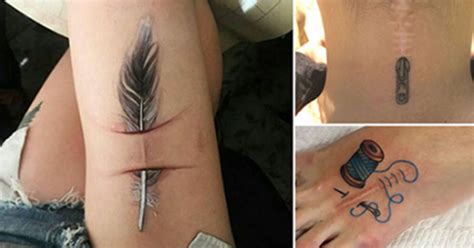 24 Amazing Tattoos That Turn Scars Into Works Of Art