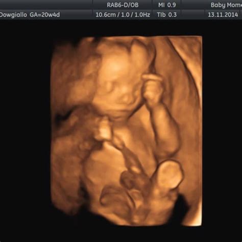 4d Baby Scan Done At The Clinic Baby Moments Baby Scan Baby