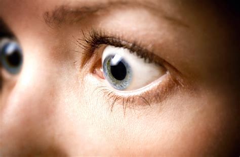Causes Of Exophthalmos Or Bulging Eyes Iris