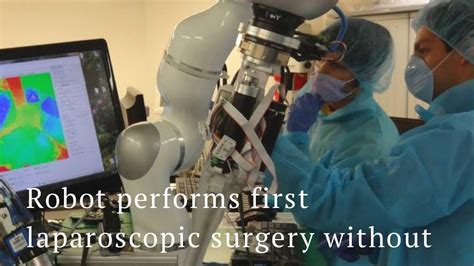 Robot Performs First Laparoscopic Surgery Without Doctors Help