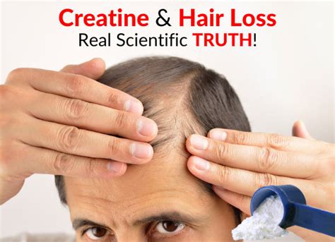 Daily for about 3 weeks or so and started having serious hair loss on the top of her head. Creatine & Hair Loss - Real Scientific TRUTH!