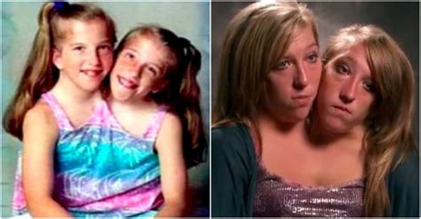 here s what conjoined twins abby and brittany hensel look like today viraly