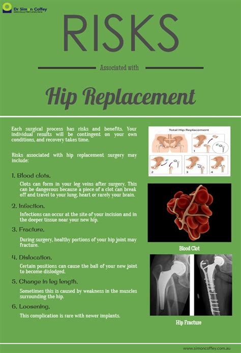 25 Best Total Hip Replacement Surgery Recovery Images On Pinterest