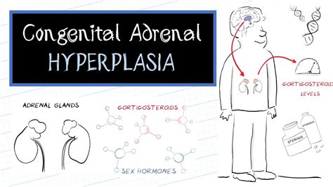 what is congenital adrenal hyperplasia cah youtube