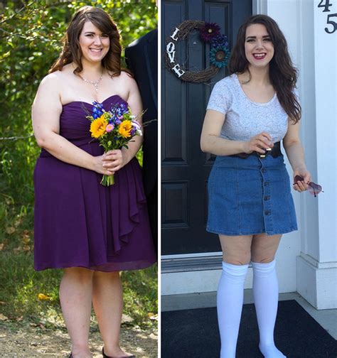 10 Incredible Before And After Weight Loss Pics You Won’t Believe Show The Same Person Bored