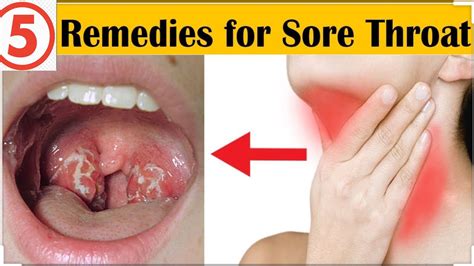 5 Home Remedies For Sore Throat Med In A Minute Dandn Medical Series Youtube