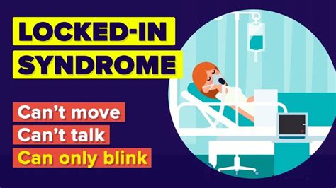 Video Infographic What Is Locked In Syndrome Worst Thing That Can Happen To You