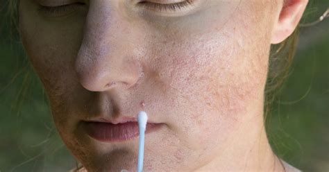 How To Get Rid Of Allergic Reactions On Your Face Such As Blemishes Or