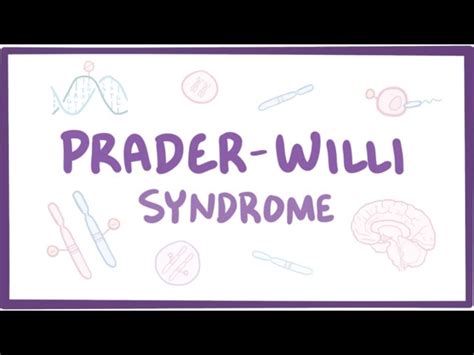 Prader Willi Syndrome Causes Symptoms Diagnosis Treatment The
