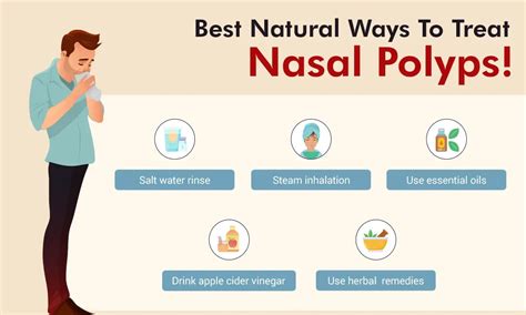 The Ultimate Guide To Removing Nasal Polyps Removemania