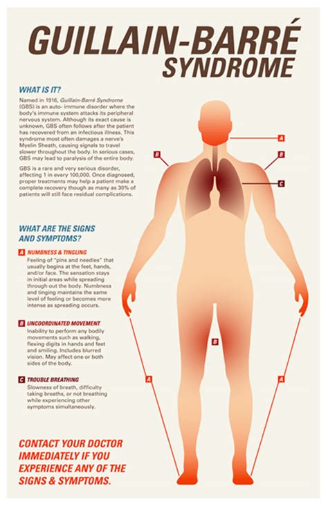 The road to recovery can be long and difficult for many. What is Guillain-Barre Syndrome? | Health Life Media
