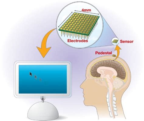 Braingate Brain Machine Interface Takes Shape