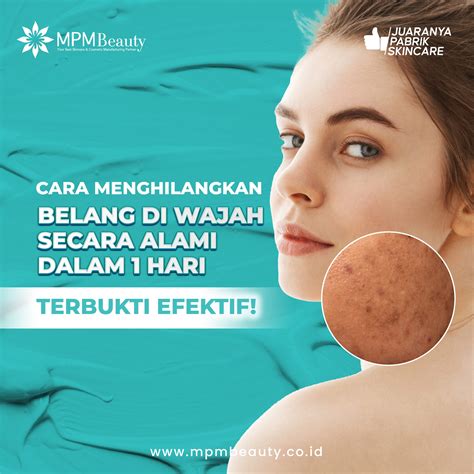 Cara Menghilangkan Belang di Wajah Secara Alami Dalam 1 Hari, Terbukti