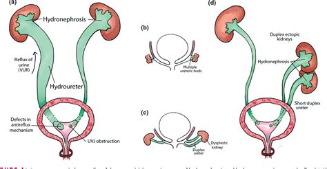 Figure 4 From Lower Urinary Tract Development And Disease Semantic