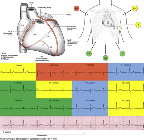Coronary Arteries Positioning Of Ecg Leads