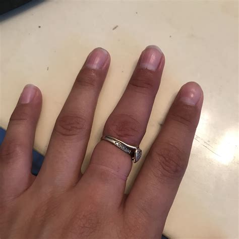 Https://tommynaija.com/wedding/finger Swollen Around Wedding Ring