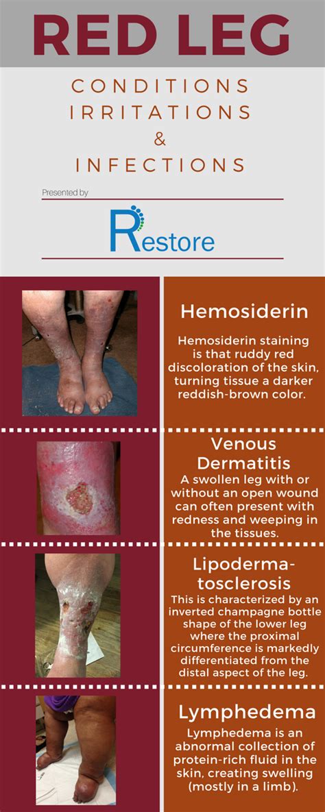 Red Leg Conditions Irritations And Infections Innovative Wound