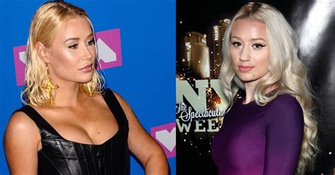 Iggy Azalea S Nose Breasts Before And After Plastic Surgery