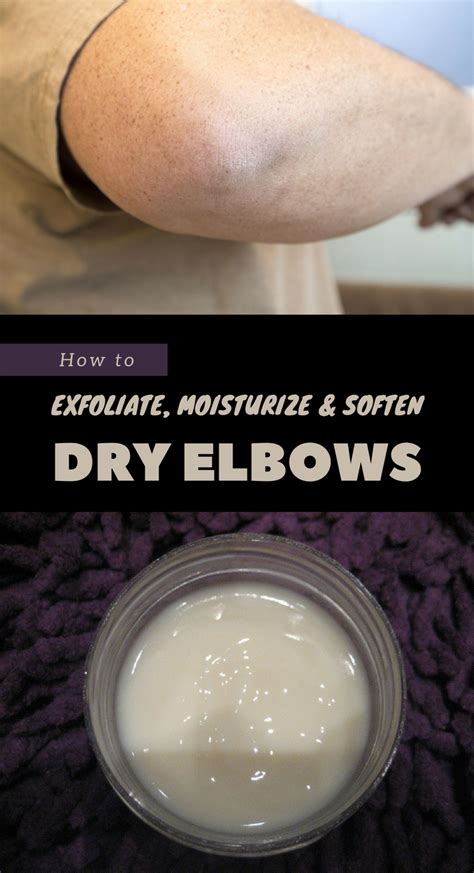 How To Exfoliate Moisturize And Soften Dry Elbows Dry Elbows Dry