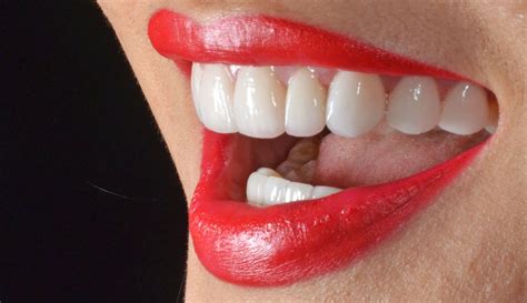 Elite Dental Explains The Science Of A Great Smile Saigoneer