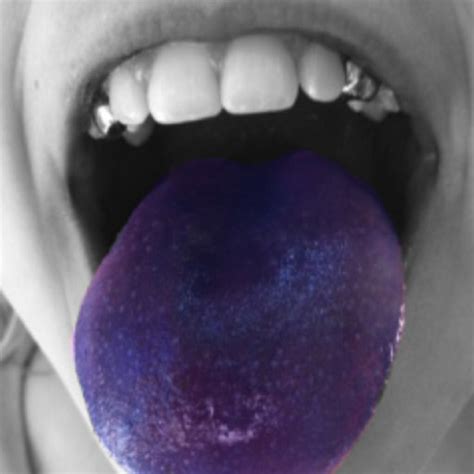 My Friends Galaxy Tongue After Eating A Red Snow Cone Then A Blue