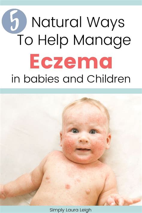 5 Ways To Manage Eczema In Babies And Children Simple Laura Leigh