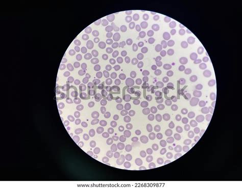 Abnormal Red Blood Cells Morphology Macrocyte Stock Photo 2268309877