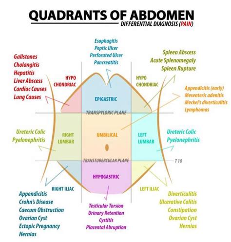 Diagram Quadrants Of The Abdomen Diagramaica