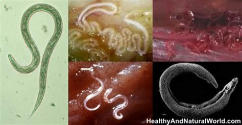How To Get Rid Of Worms In Humans Including Parasite Cleanse Diet