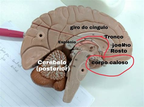 Esplenio Do Corpo Caloso