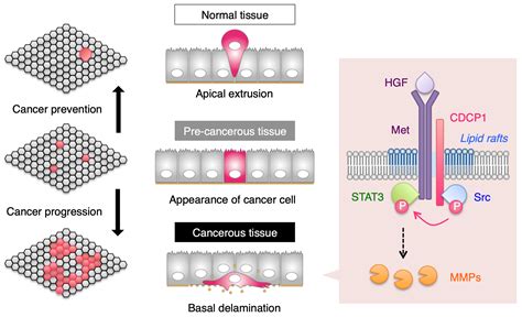 Breakthrough In Study Of How Epithelial Cells Become Cancerous Resou