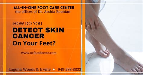 How Do You Detect Skin Cancer On Your Feet