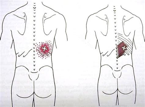 Serratus Pos Inf Trigger Point Diagram Trigger Points Love Massage