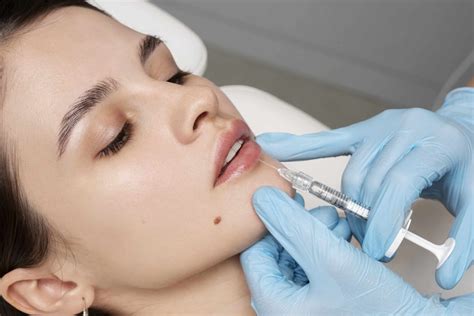 6 things you should know before getting lip injections lumina aesthetics