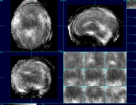 New Technology Images Fetal Brain Activity In 4d Uw Bioengineering