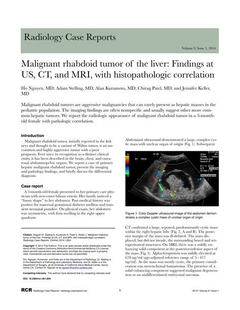 Pdf Malignant Rhabdoid Tumor Of The Liver Findings At Us Ct And