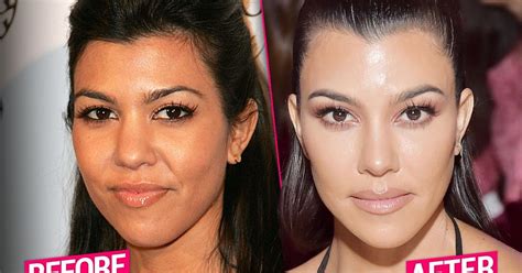 kourtney kardashian s massive plastic surgery makeover exposed by top docs
