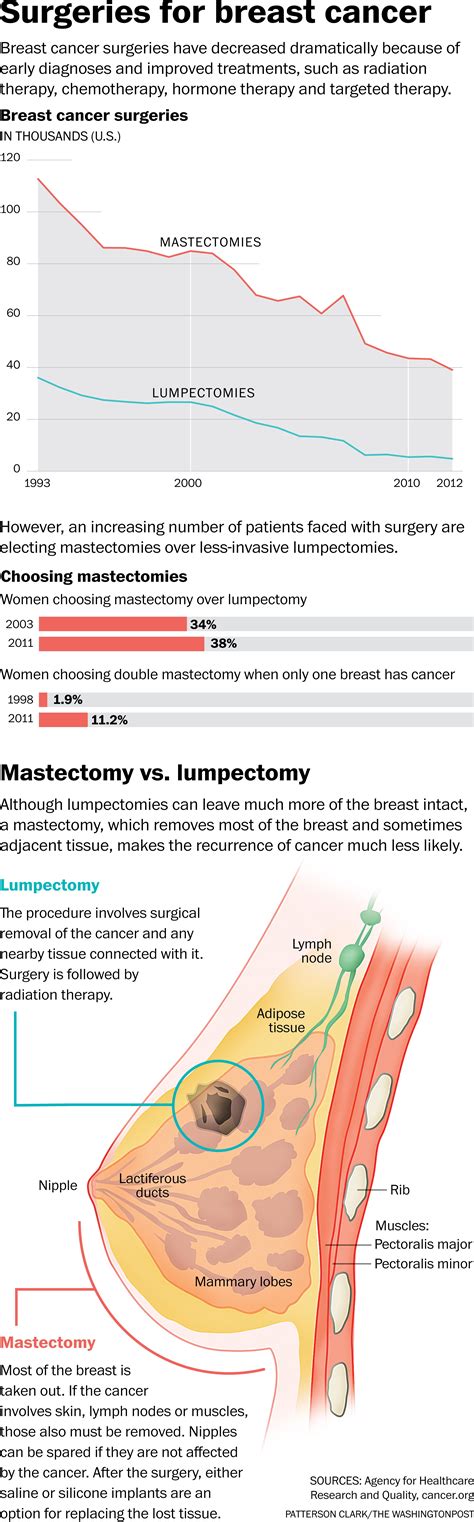 Even For Tiny Lumps More Women Are Choosing Double Mastectomy The