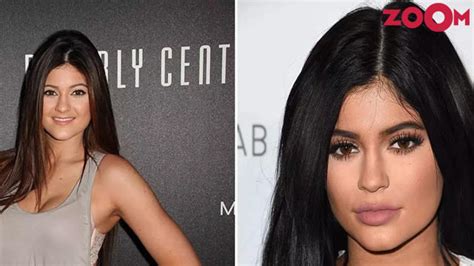 kylie jenner gets rid of her lip fillers and more