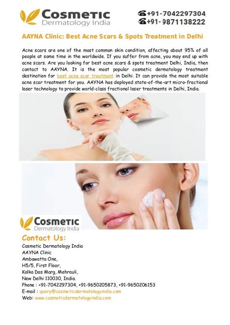 Best Acne Scars Treatment In Delhi India Aayna Clinic