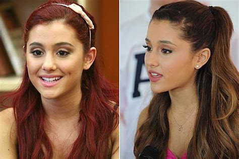 Ariana Grande Before After Ariana Grande Plastic Surgery Revealed