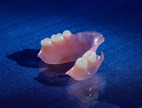 Valplast Flexible Partials Planning For Case Success Burbank Dental Lab