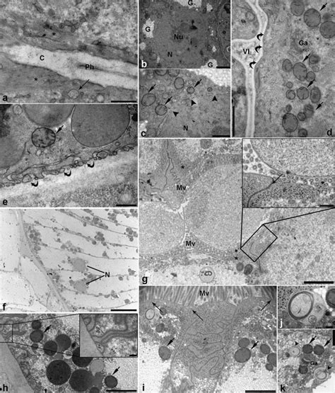 Representative Electron Micrographs Of Third Stage Anisakis Pegreffii