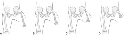 Congenital Anomalies Of Bone Clinical Gate