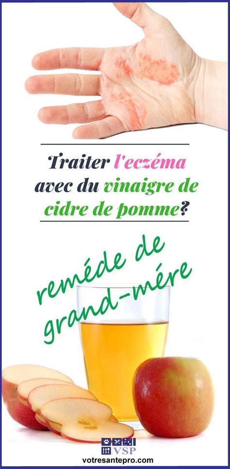 We did not find results for: Comment traiter l'eczéma avec du vinaigre de cidre de ...