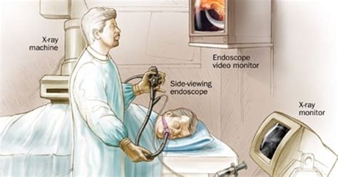 Room Set Up And Patient Positioning For Endoscopic Retrograde