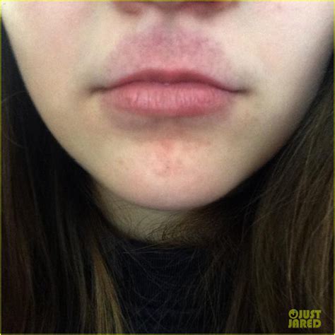Kylie Jenner Challenge Is Making Headlines See These Crazy Lip Pics