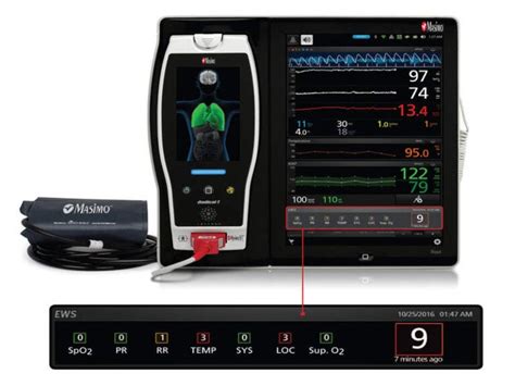 Masimo Launches Root Patient Monitoring With Ews Medical Device Network
